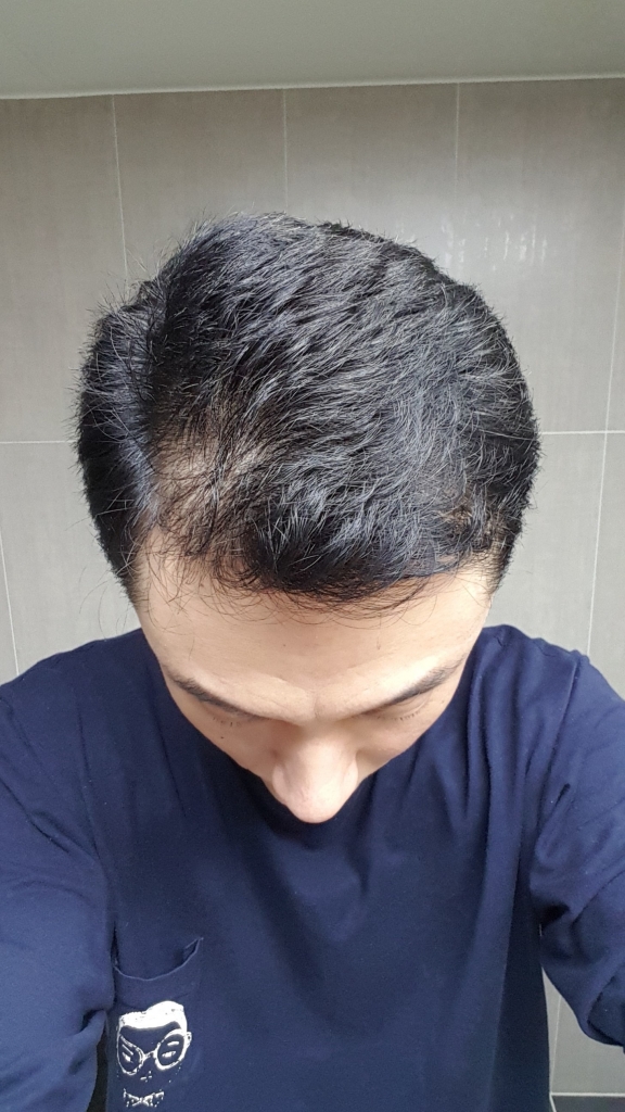 20170401_124422.jpg