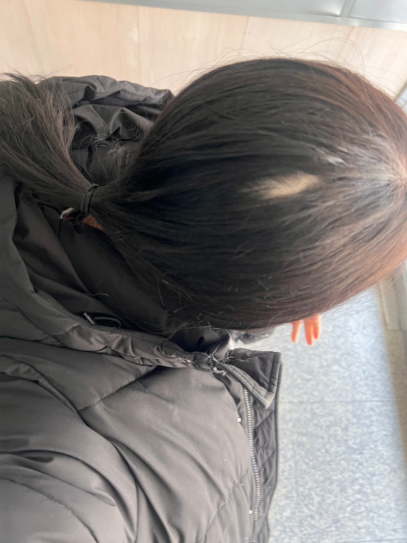 정수리2.jpg