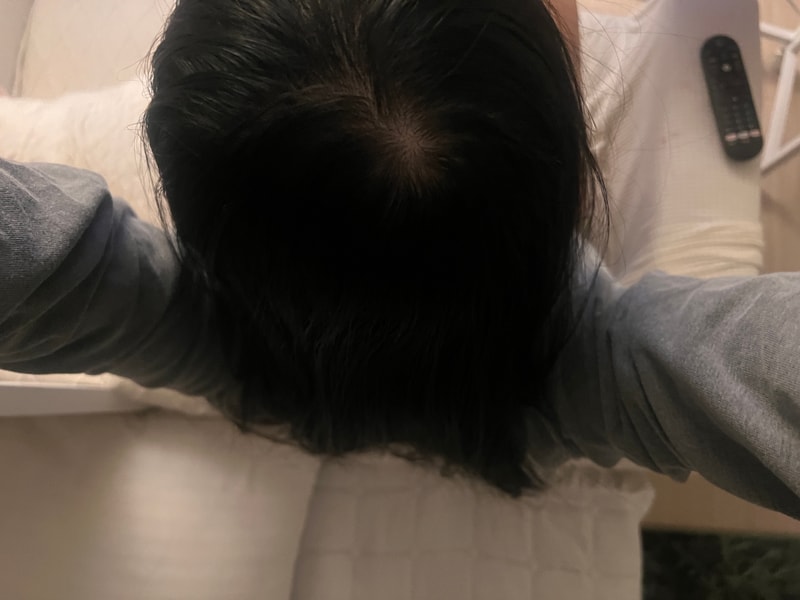 정수리1.jpg
