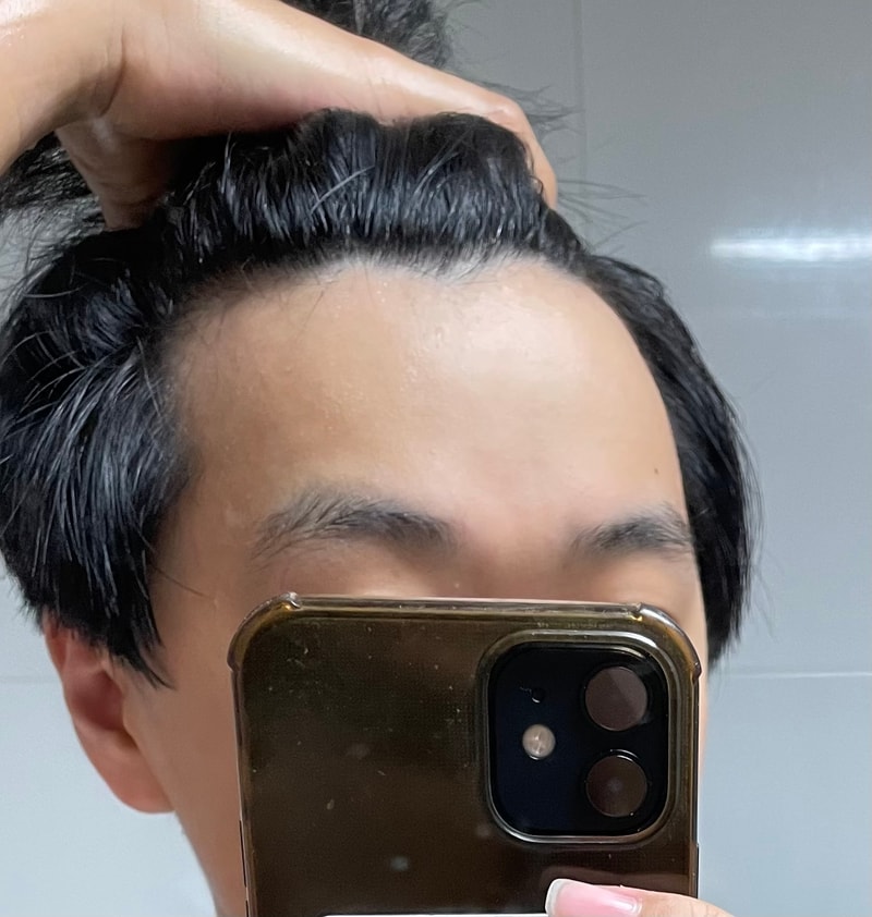 엠자 초기일까요 형님들