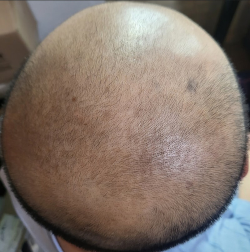 1000091730.jpg