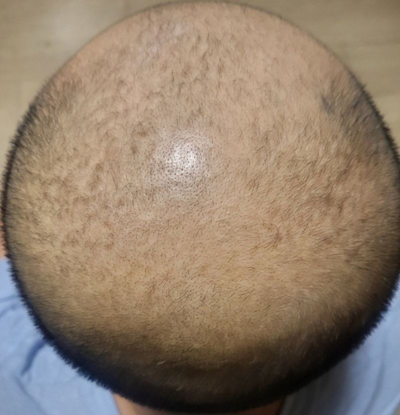 1000091731.jpg