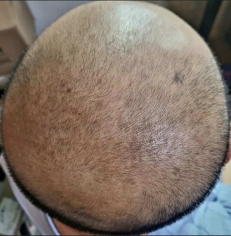 1000091733.jpg