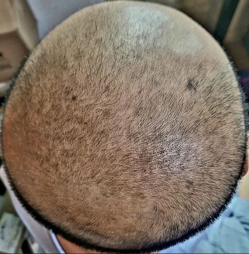 1000091734.jpg