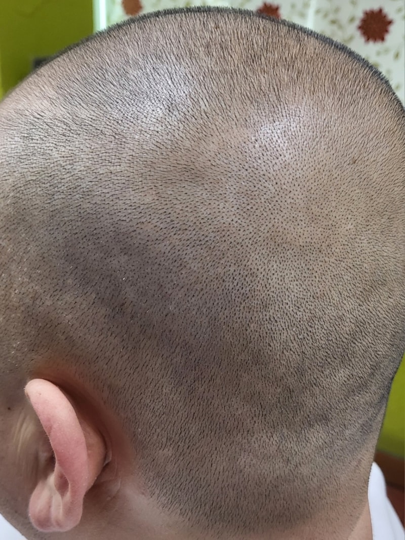 1000091725.jpg