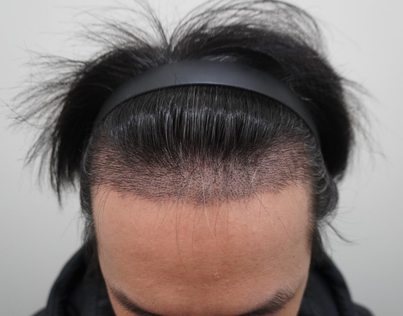 2주.JPG