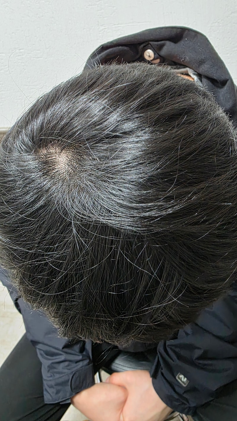 20260323_171433.jpg