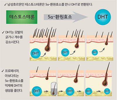 피나 두타 미녹 탈모약 직구