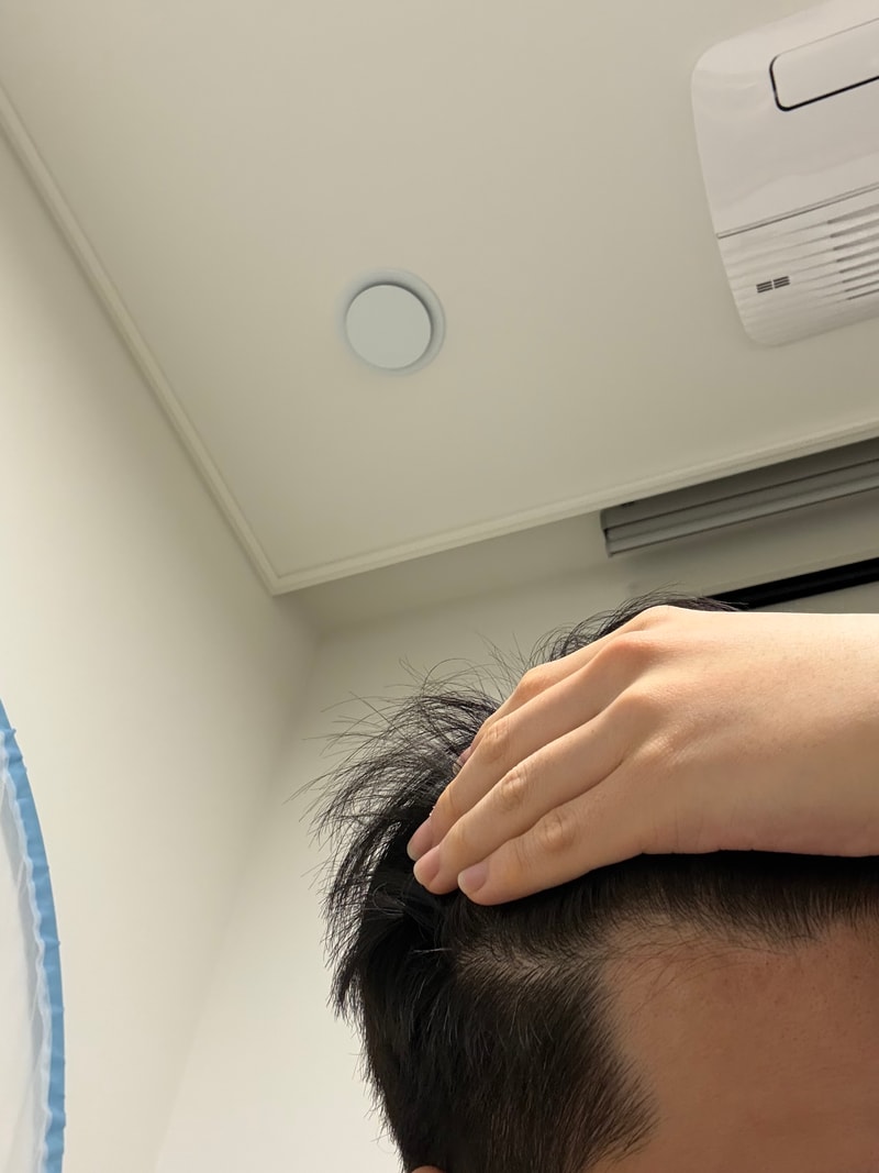 탈모같아서 걱정되어요ㅜㅜ