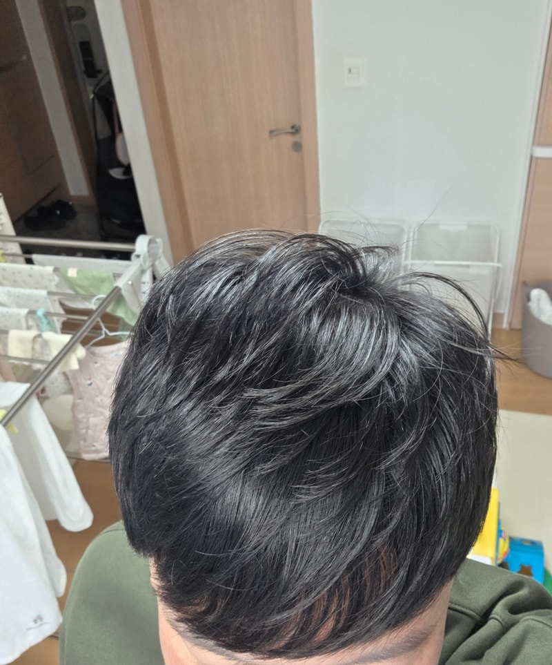 현재 탈모약 19년차 먹고있어요(장기복용 후기)