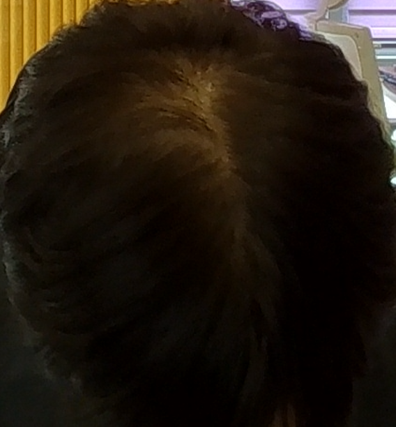 정수리.png