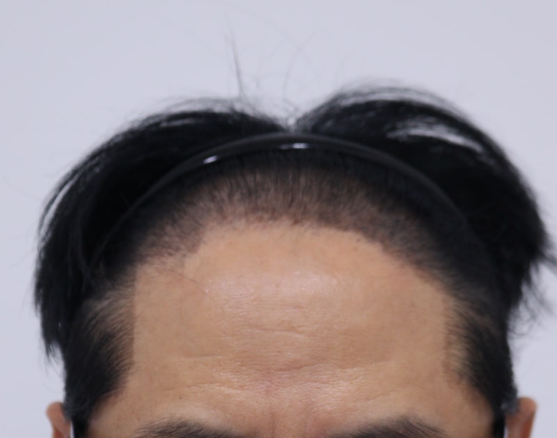 1. 수술전_1.JPG