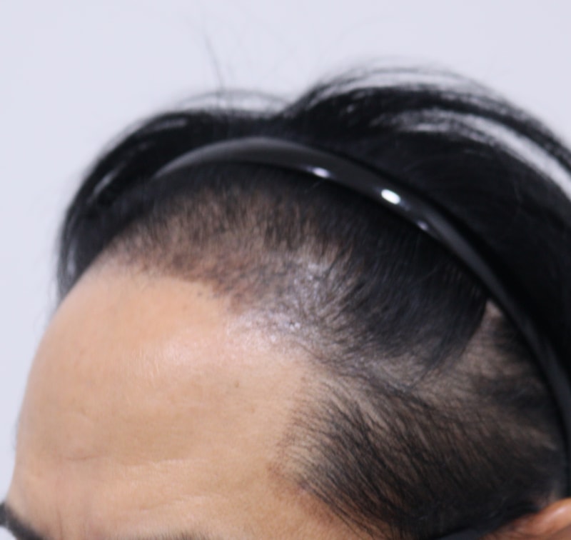 1. 수술전_2.JPG