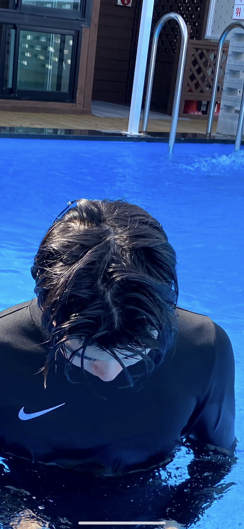 피나 복용 약 2년차