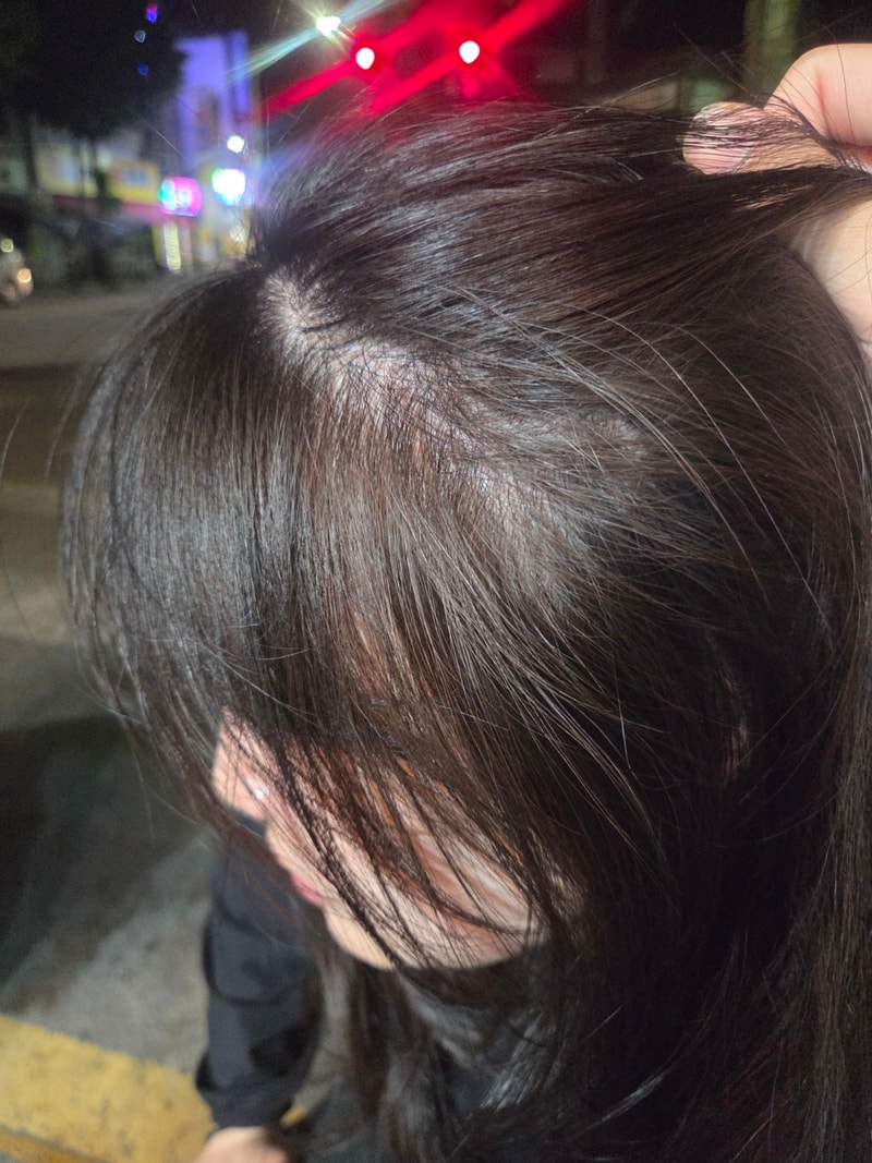 탈모인지 봐주세요ㅜ 