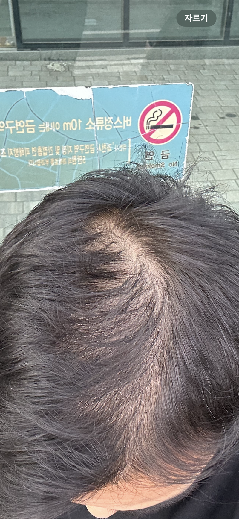 탈모수다