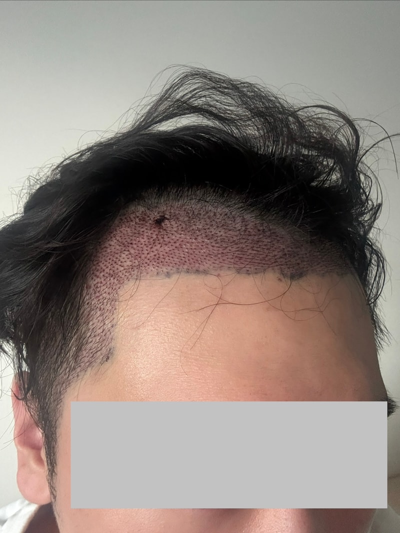 3일차인데 경과 괜찮은걸까요?