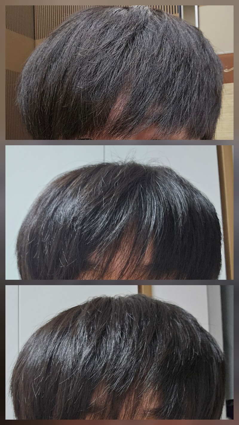 앞머리 가운데가 머리가 빠지는 거 같아요