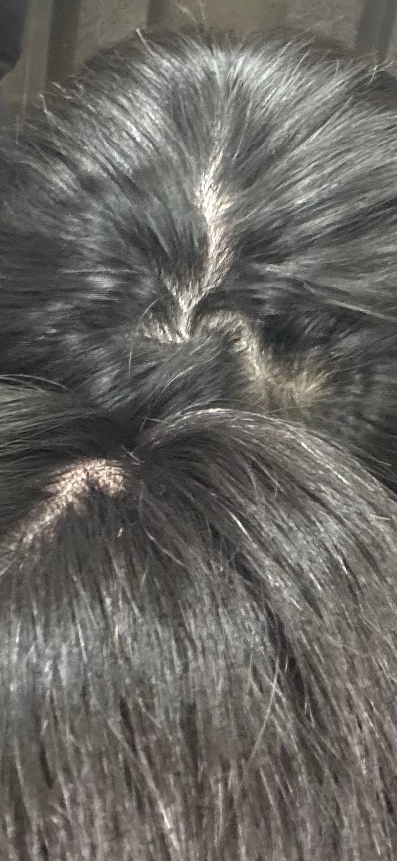 정수리 가르마 탈모 인지 봐주세요