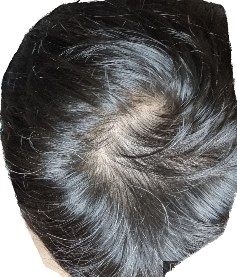 1785021381_2flqhiB1_dabbed3684d514f51be10c3c1759bcdb31b028ca.png