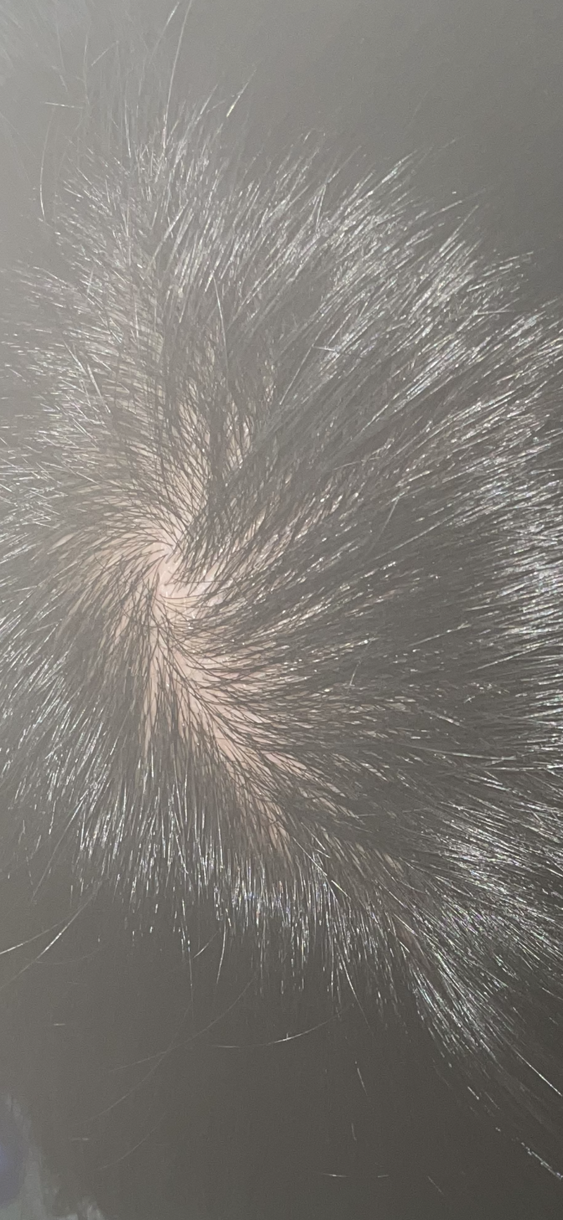 88F099FB-3C3D-4CEF-8C01-D26A1458B77A.png