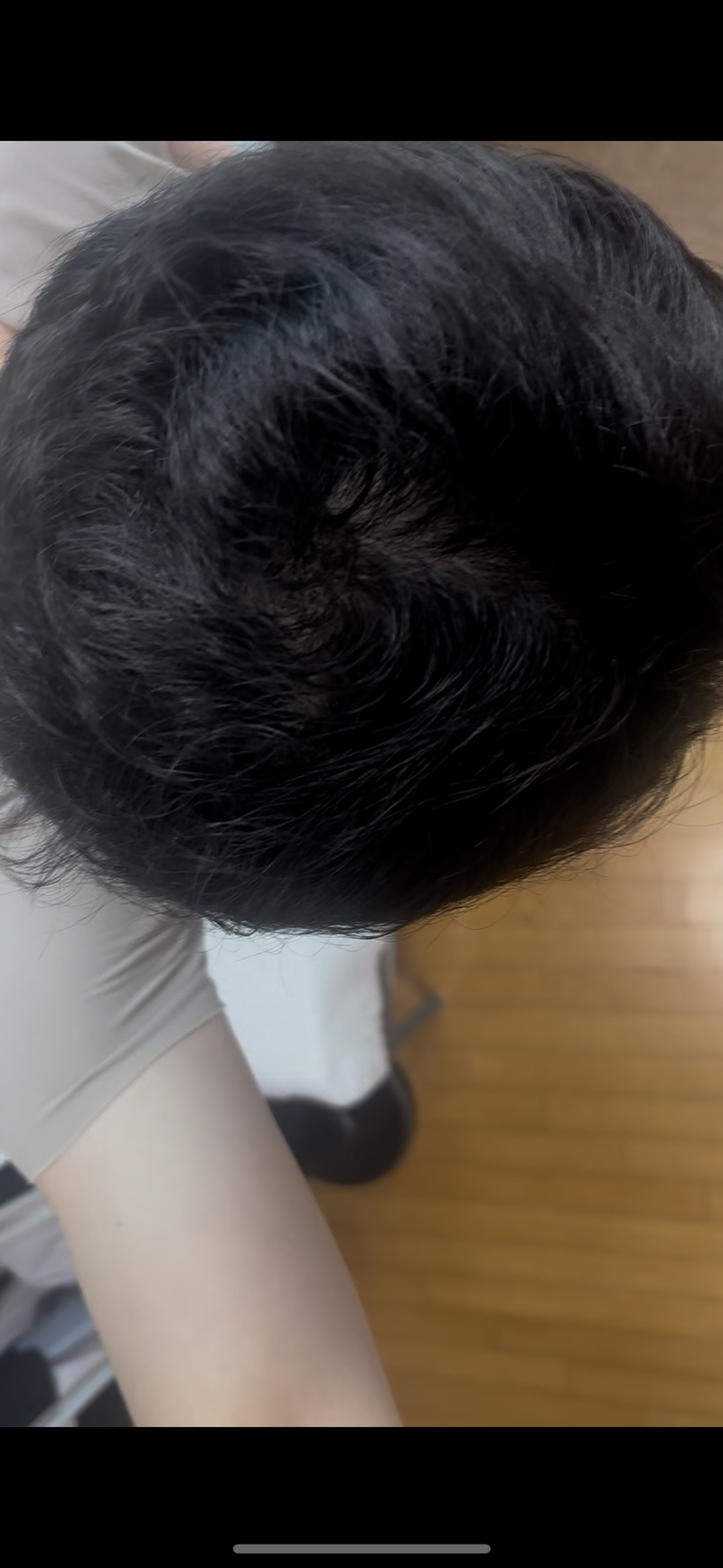 남자 정수리 이렇게 찍는거맞나요?