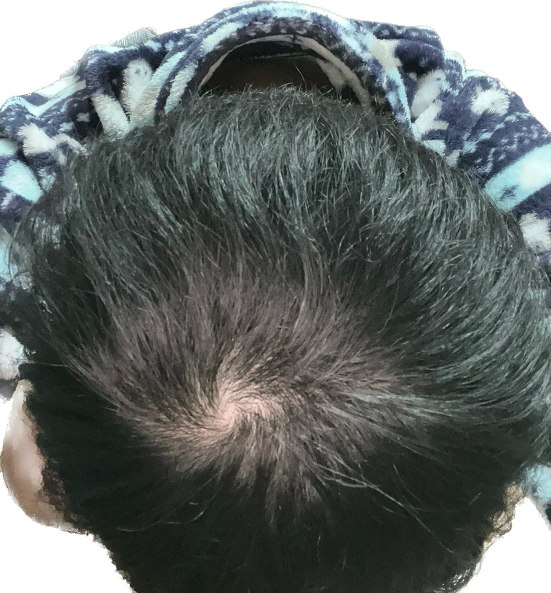 D6632E3D-59A9-4B03-8F0D-68067AB43054.png