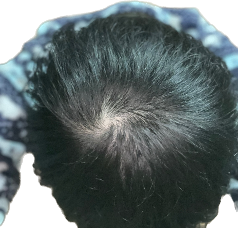 308623CD-4C6A-4FA2-902F-0FF87C8964EB.png