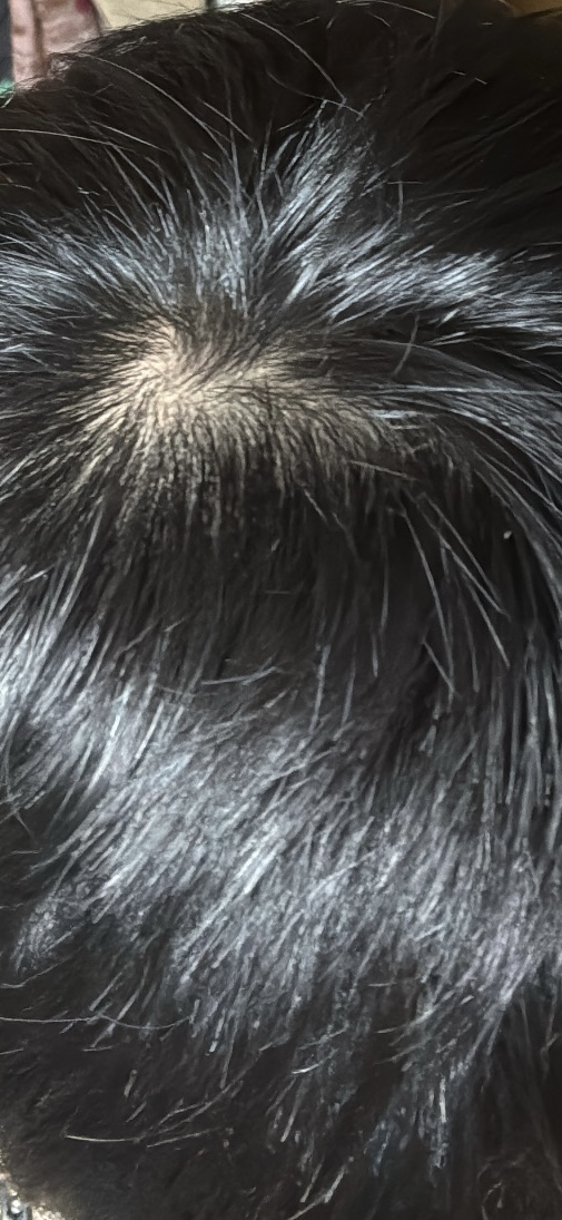 AA07BEC0-2D33-4B03-9BDA-5175F7E12A57.jpeg