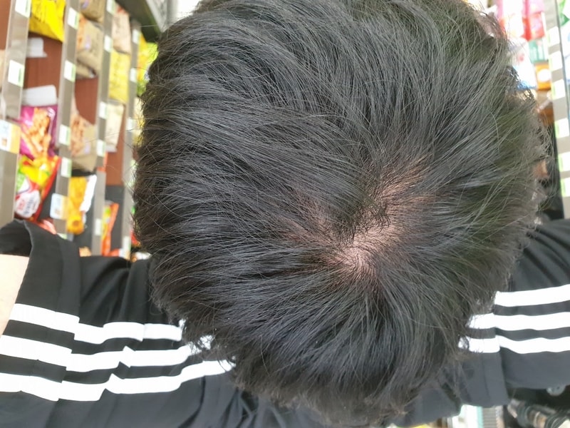 20180920_044910.jpg