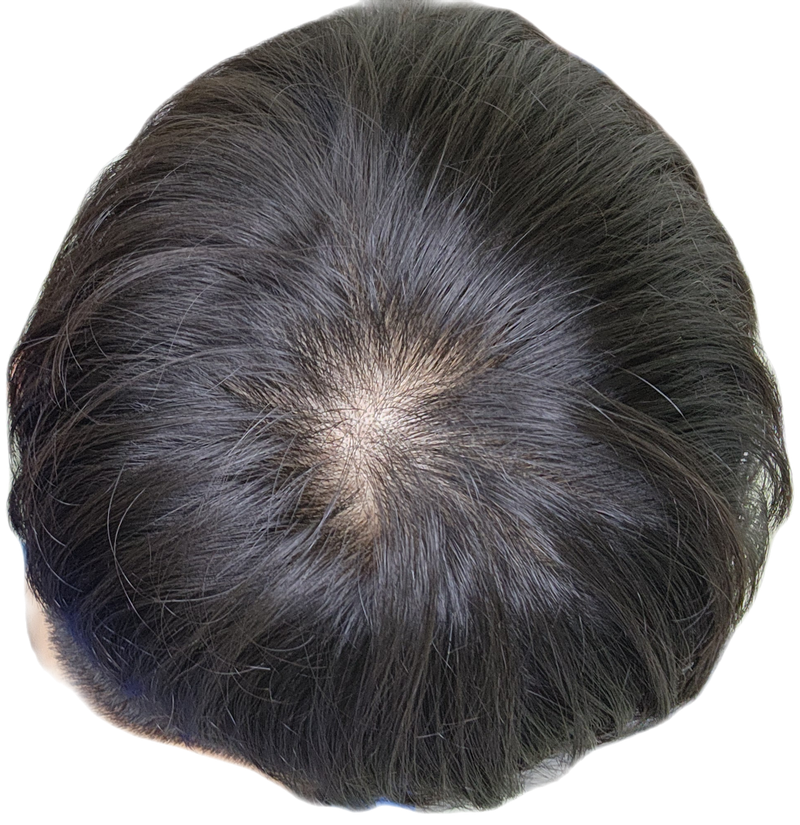 1000011363.png