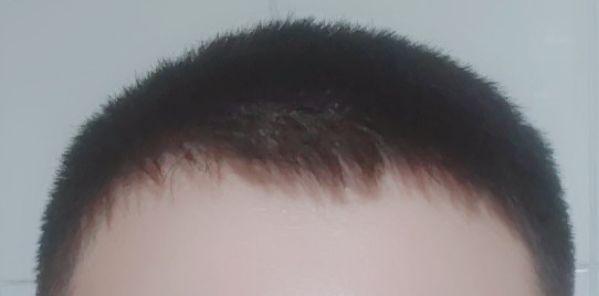1000000162.jpg