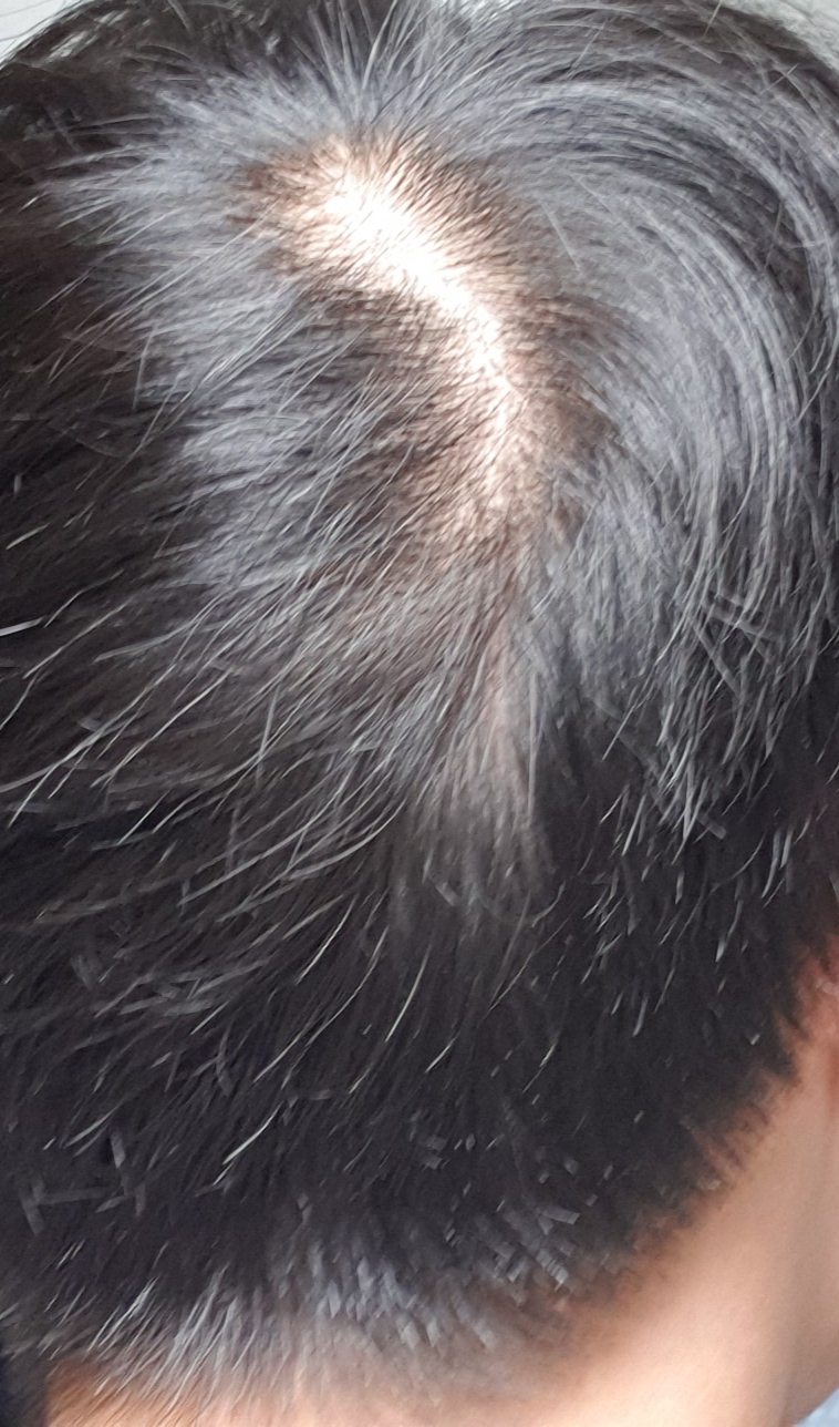 20191120_081019.jpg
