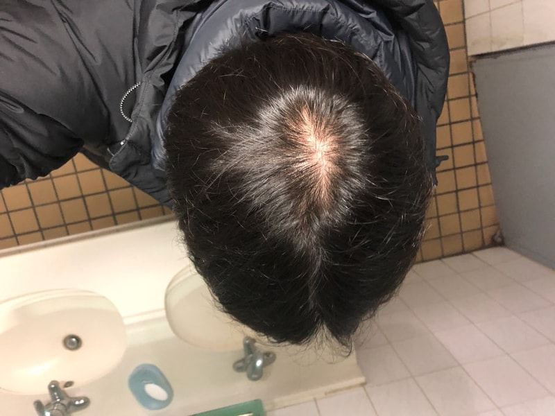 KakaoTalk_20180308_153304974.jpg