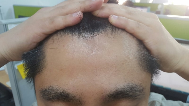 20170426_092418_resized.jpg