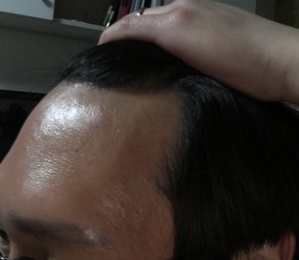 M자 왼쪽_2.jpg