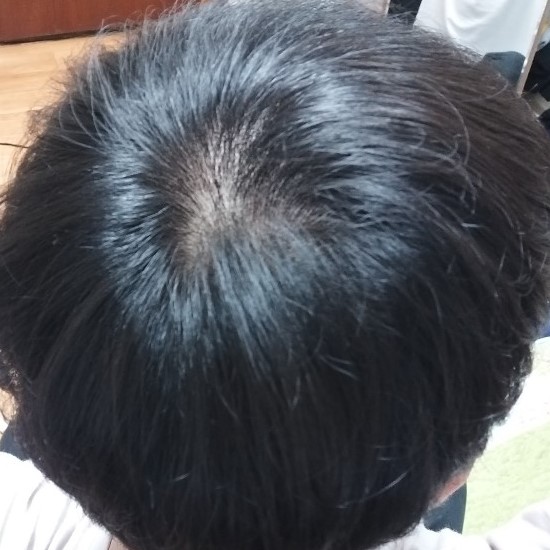 일반2.jpg