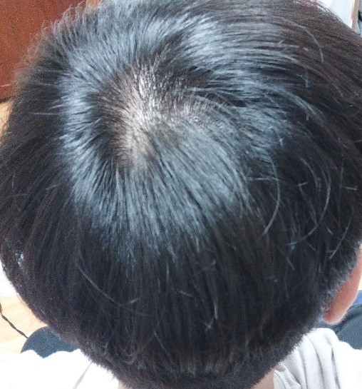 일반1.jpg