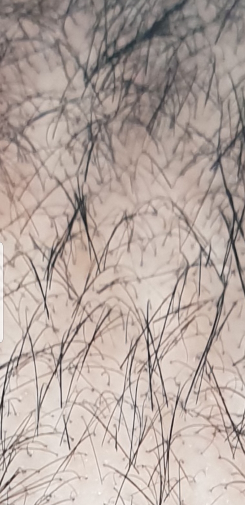 Screenshot_20181110-153806_Gallery.jpg