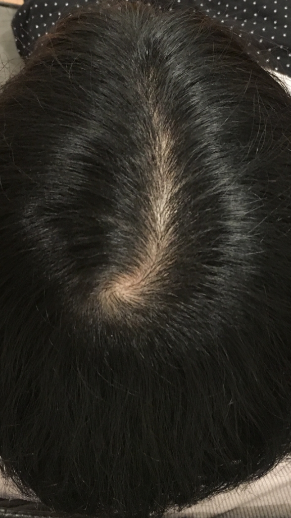 7EA5762E-BB17-4A4A-9F16-0205AF62E8C2.png
