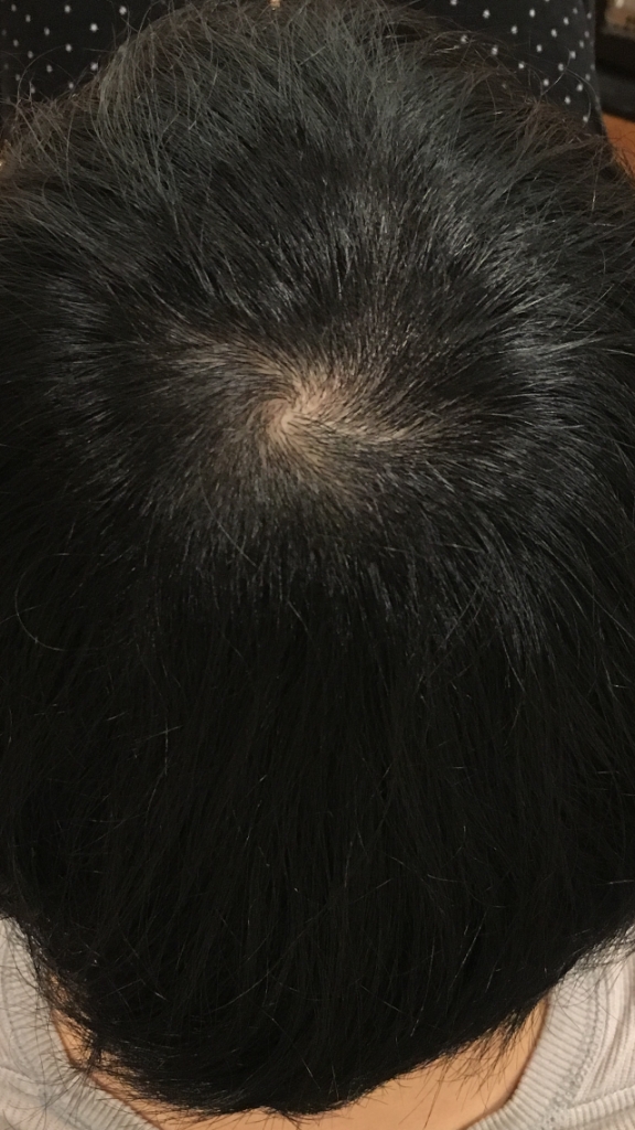 C5A1BB1D-03B8-45ED-8D0E-AA8461565750.png