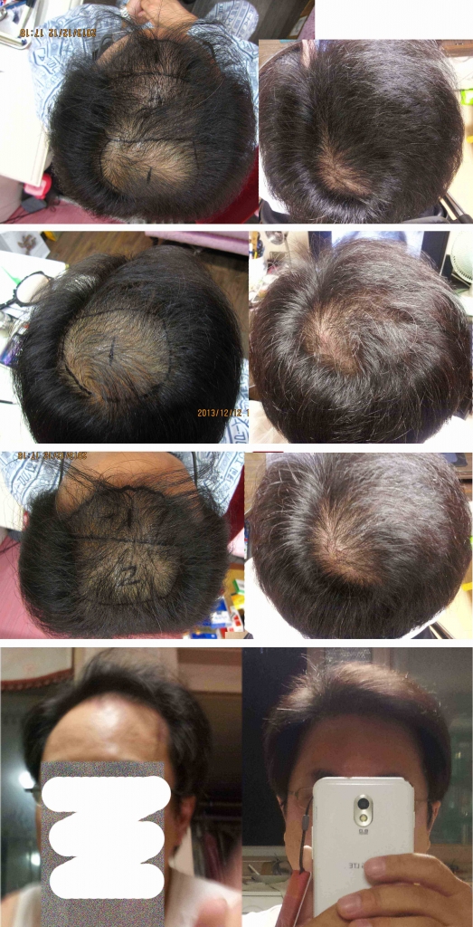Hairrrrr.jpg