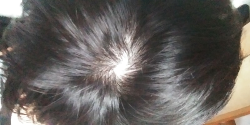 20170903_181611.jpg