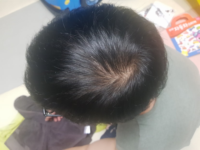 방금찍은머리 네요 자다일ㅇㆍ