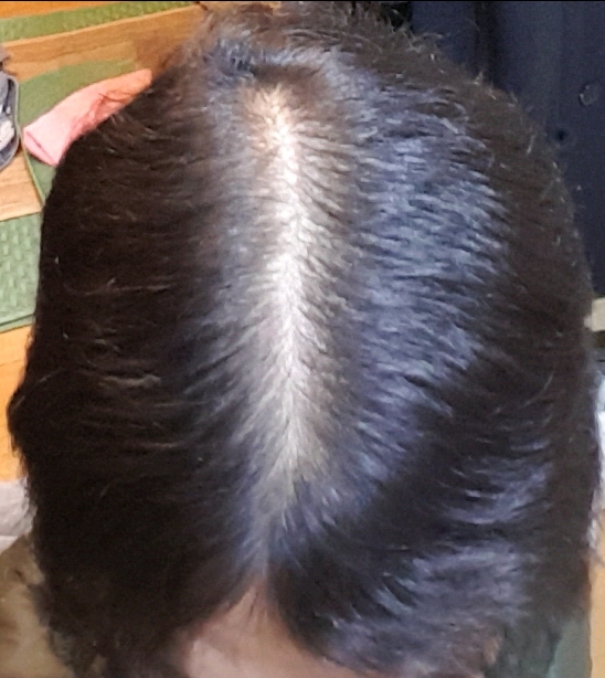 20180301_210614.jpg
