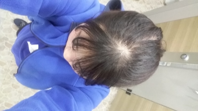 20170416_211426.jpg