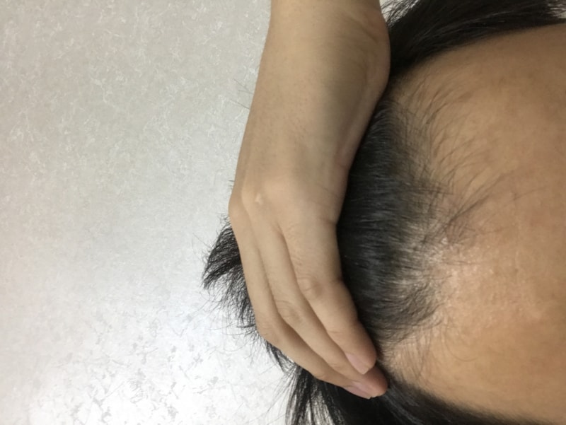 6FE9E096-3085-4D5A-A6F9-92EA64861247.jpeg