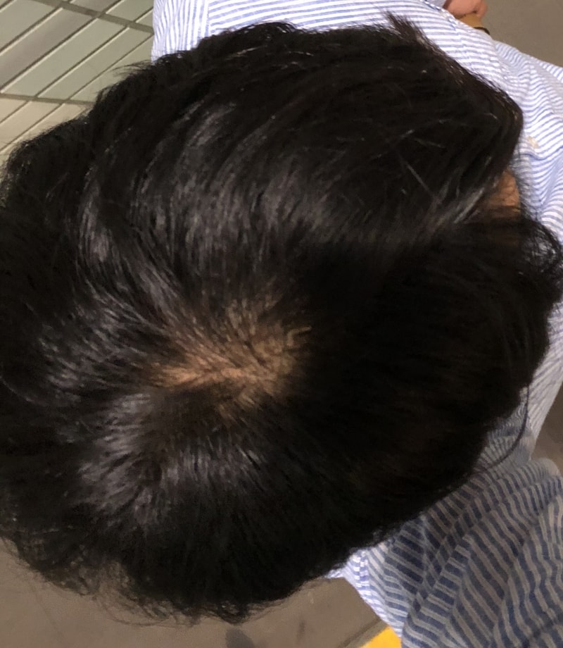 E58ACA42-D8B3-44BA-A0BA-2FDB81798581.jpeg