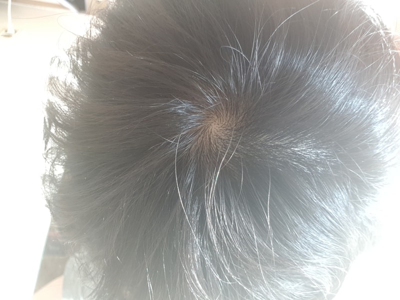 20180316_091519.jpg