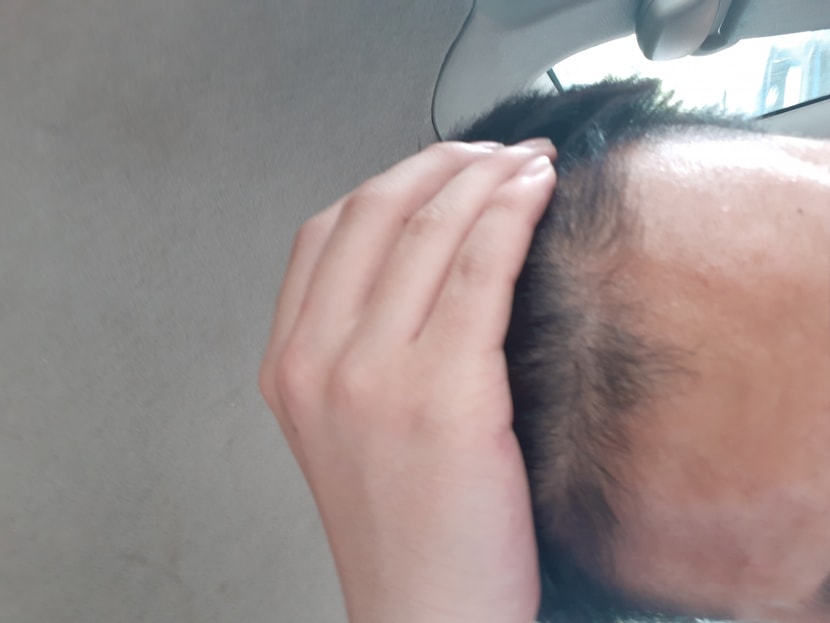 M자
